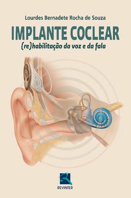 Implante Coclear