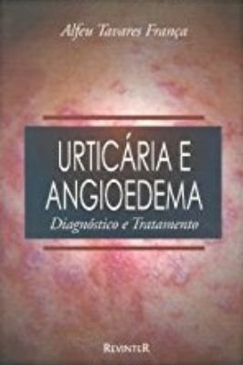 Urticaria e Angiodema. Diagnostico e Tratamento