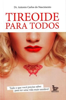 Tireoide para Todos Capa Comum – 1 Janeiro 2006