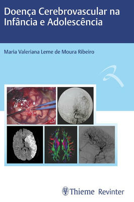 Doença Cerebrovascular na Infância e Adolescência
