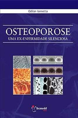 Osteoporose - uma Ex-enfermidade Silenciosa