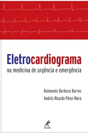 Eletrocardiograma na medicina de urgência e emergência