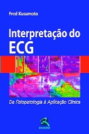 Interpretação do ECG